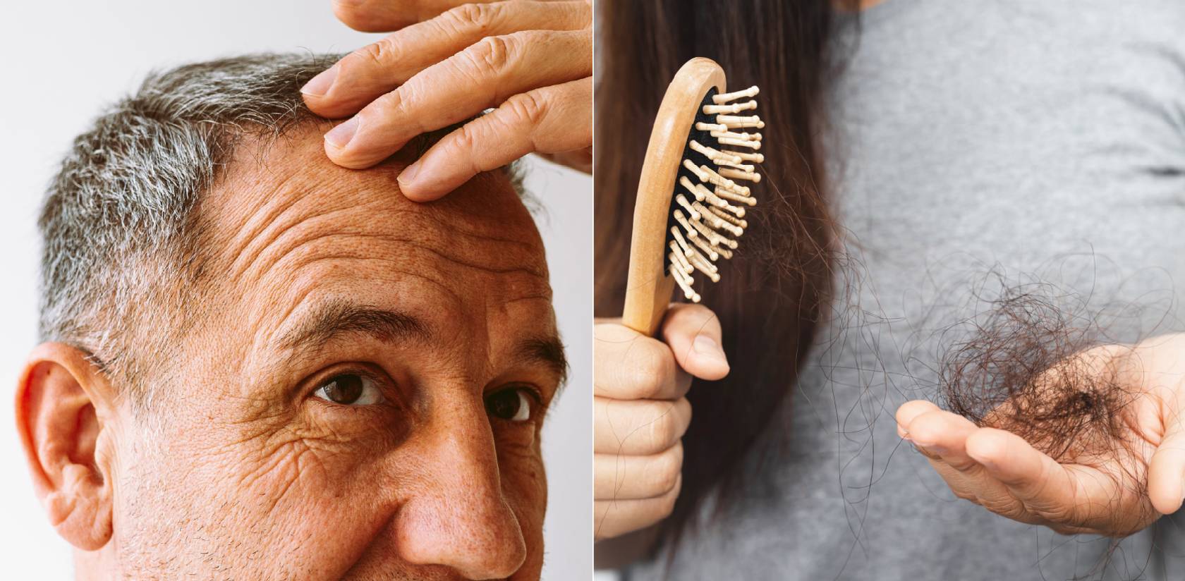 How Celluma Light Therapy Supports Hair Growth