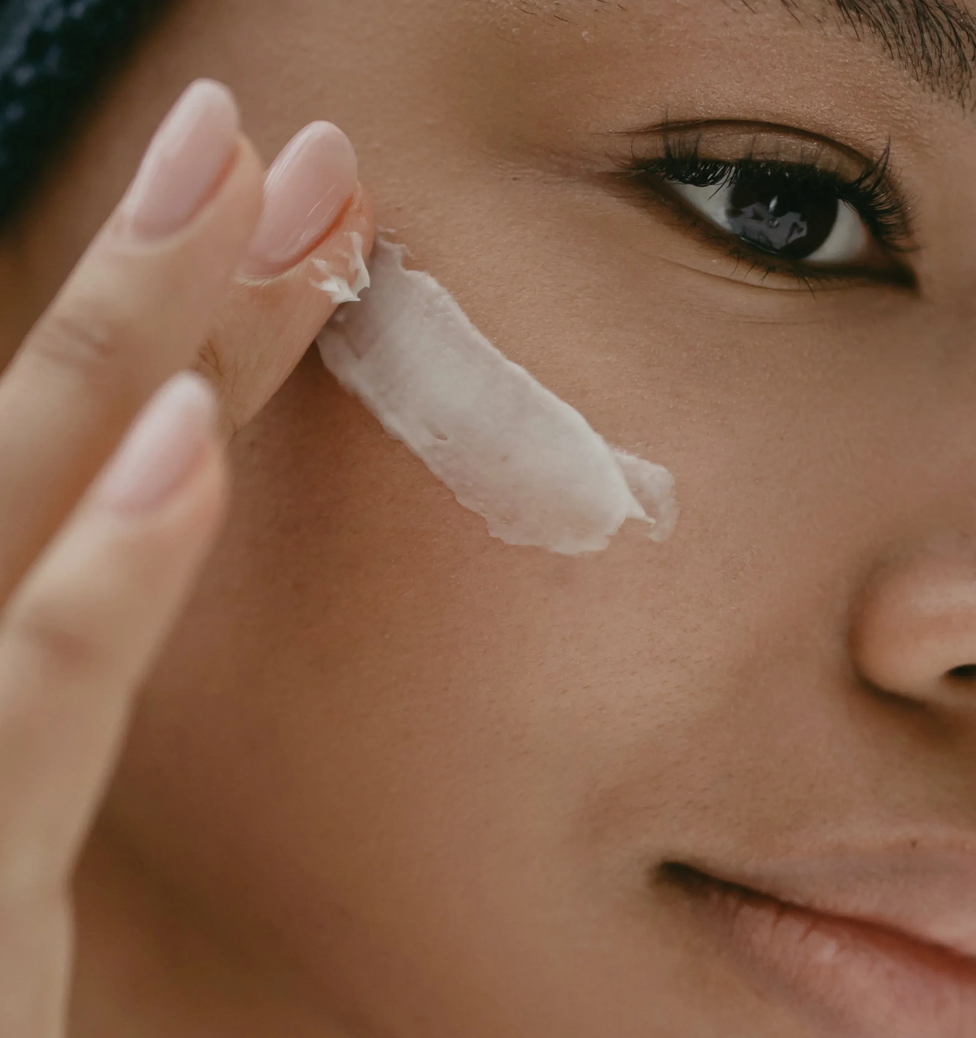Model applying moisturising cream to dry skin