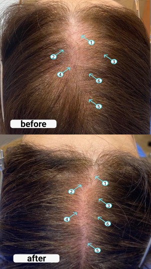 Revita | TABLETS FOR HAIR GROWTH SUPPORT