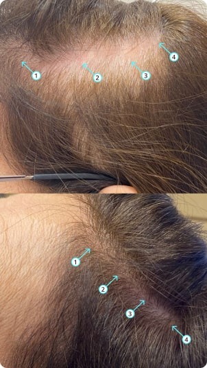 Revita 925ML | High-Performance Hair DENSITY Shampoo