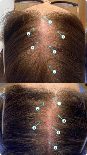 Revita 925ML | High-Performance Hair DENSITY Shampoo