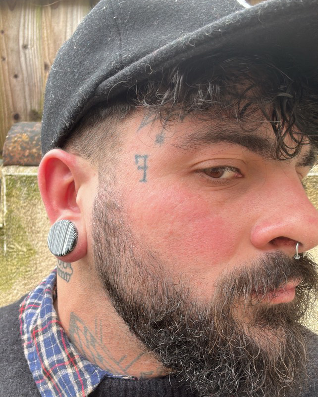 Girl wearing big  Black & White Line Stone Plug / Gauge