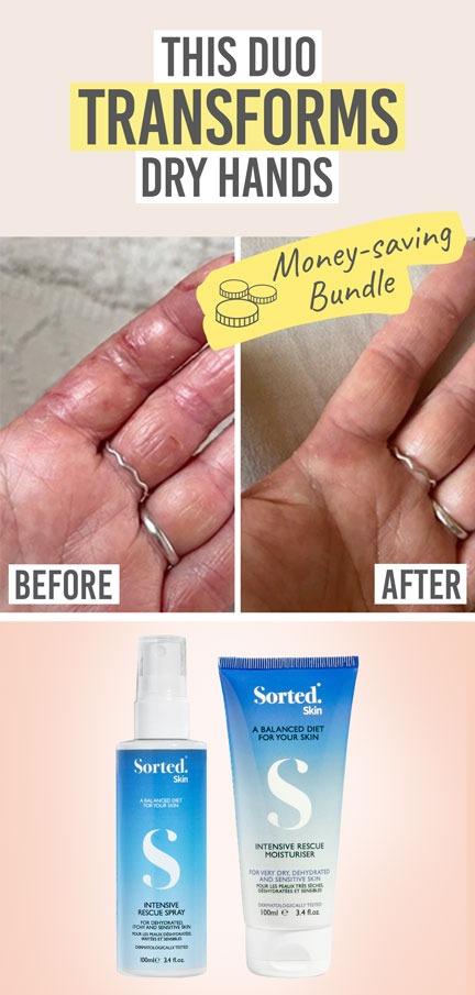 Sorted Skin Intensive Rescue Spray and Moisturiser Duo - Beauty and the Boutique - This duo transforms dry hands
