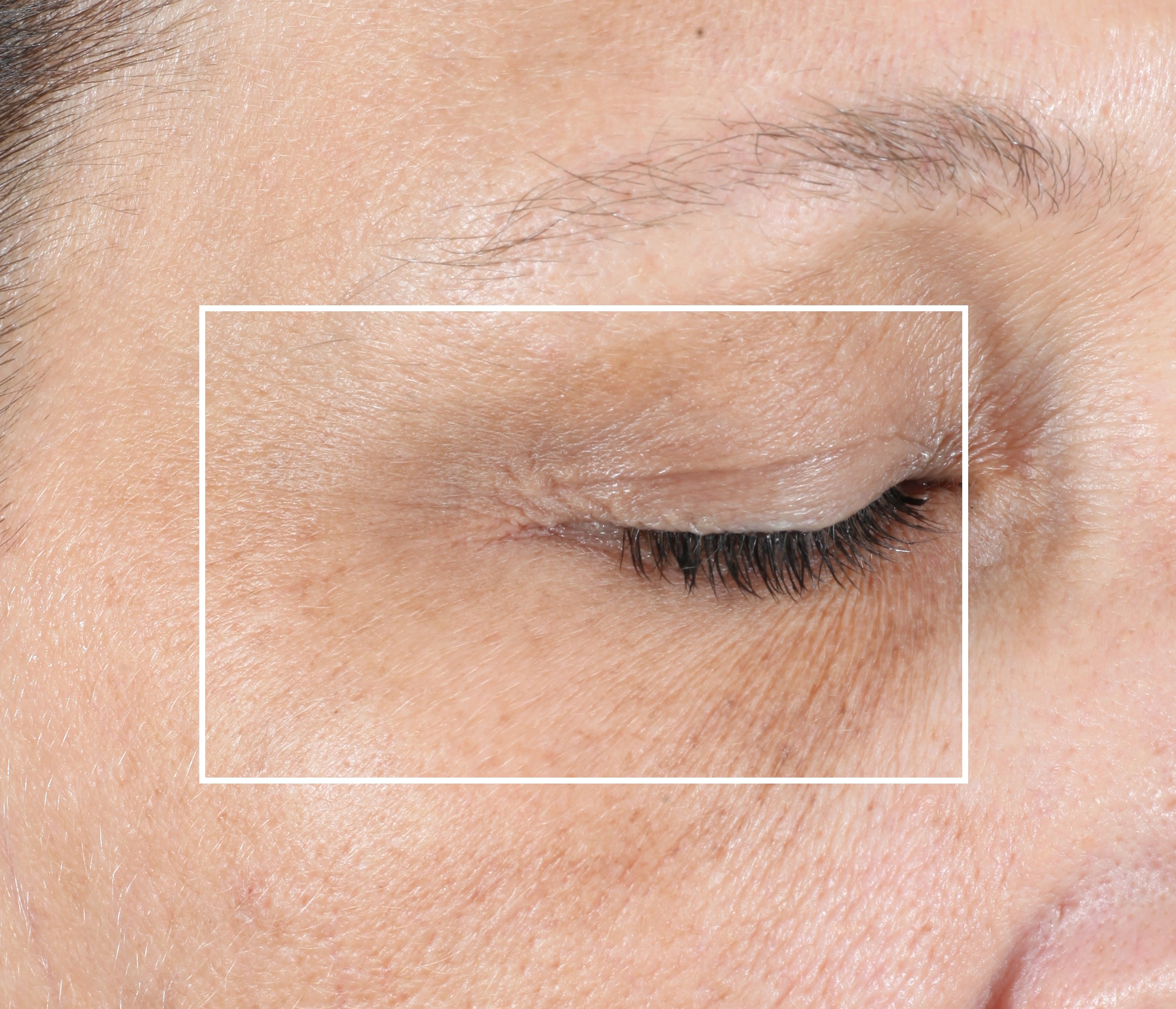 NuFACE FIX + Serum Gift Set. OFFICIAL SITE