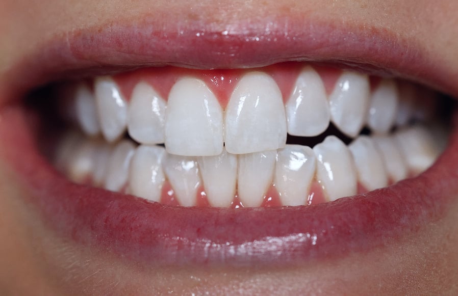 Maggie K. after treatment