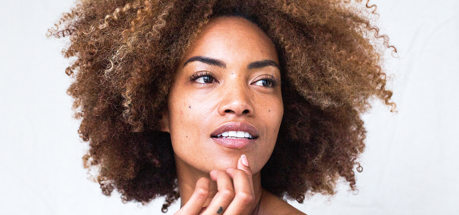 Hyperpigmentation -What Is It And Are There Any Treatments?