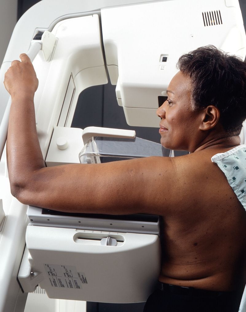 Medical Breast Exam – What you need to know