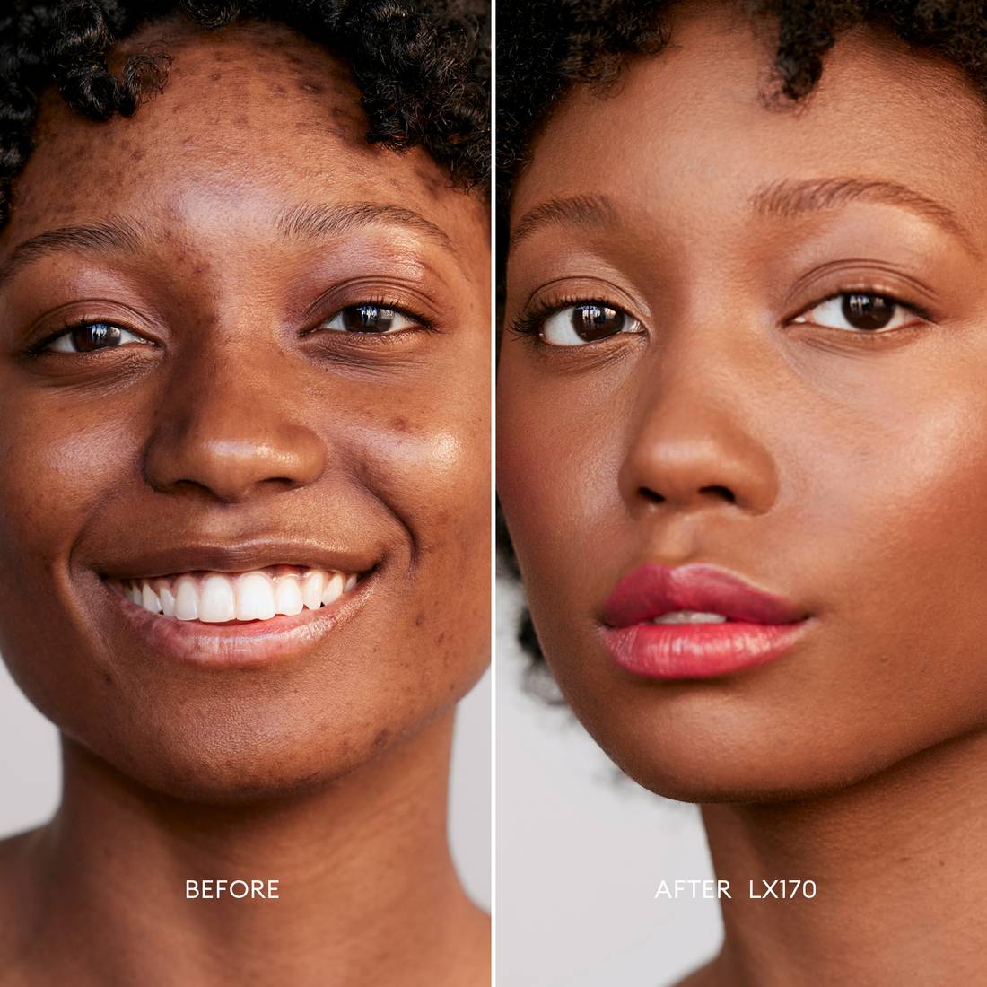 Before and after image of a Deep Skin Tone, Golden Undertone model wearing Softlight Luminous Hydrating Concealer in shade 170. 1