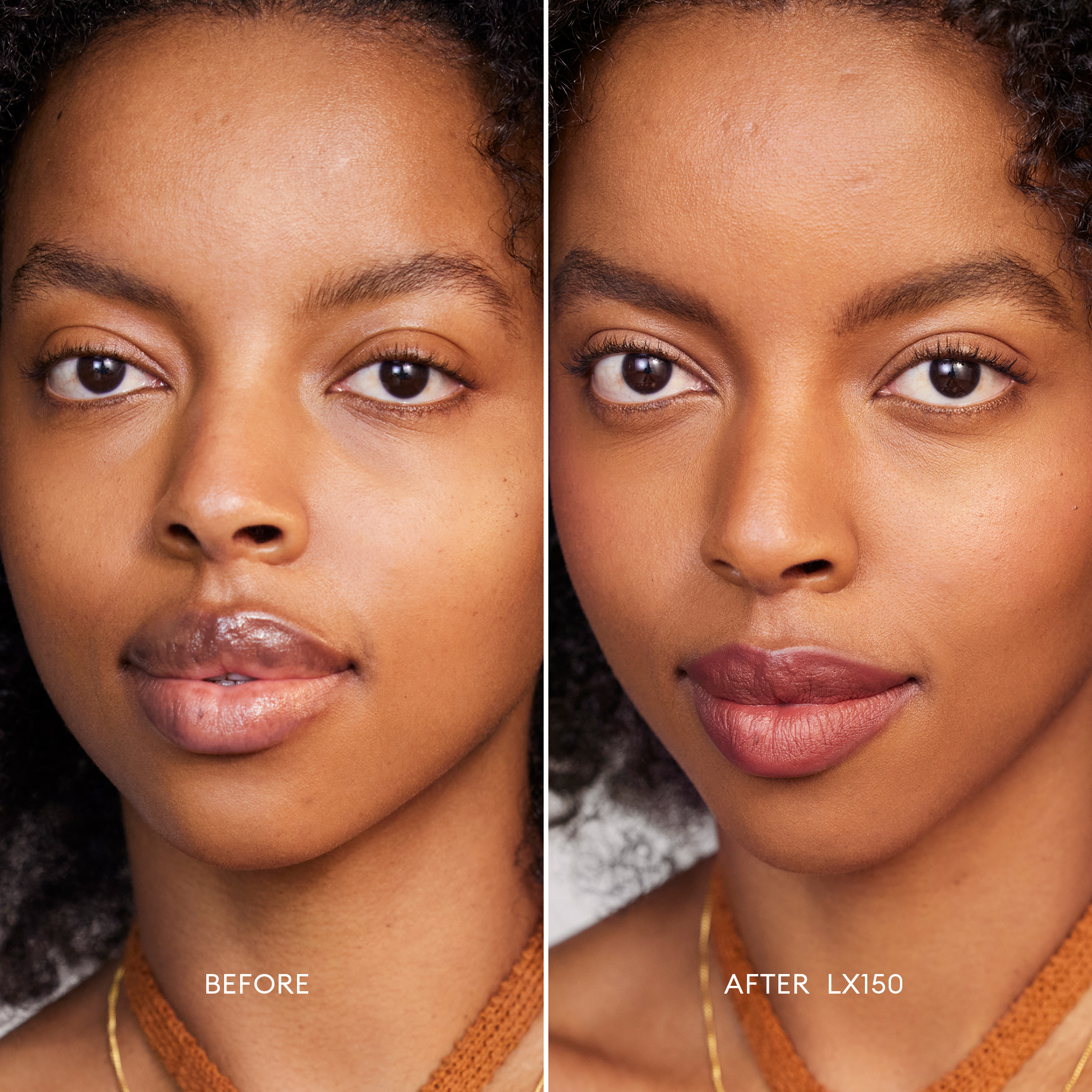 Before and after image of a Deep Skin Tone, Neutral Undertone model wearing Softlight Luminous Hydrating Concealer in shade 150. 1