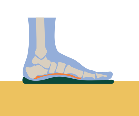Plantar Fasciitis: Causes, Definition, and Treatment