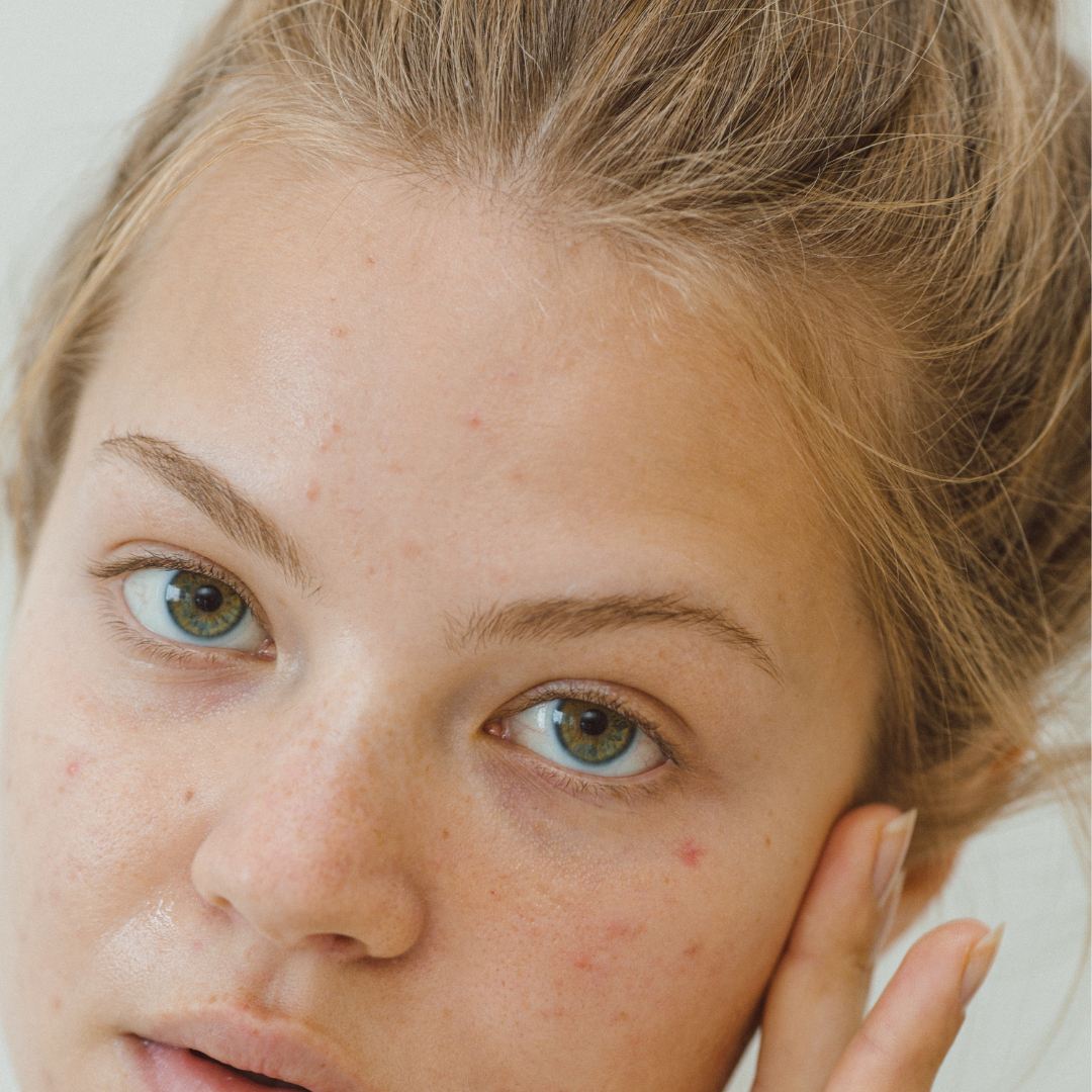 The position you sleep in can also affect your skin health. For example, sleeping on your stomach or side can cause constant friction between the sheets and your skin. This can lead to irritation and, over time, wrinkles. An easy fix is sleeping on your back. But, if you enjoy sleeping on your side, make sure your sheets are made from a soft material like silk.
