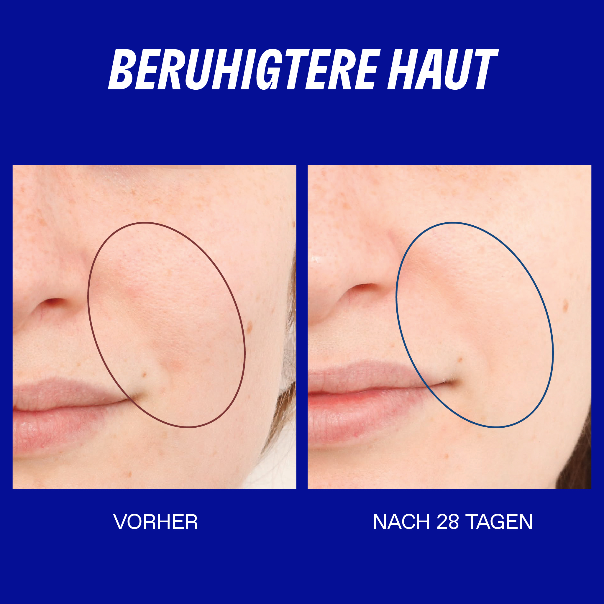 Smart Yoghurt™ Probiotisches Superserum Thumbnail 7
