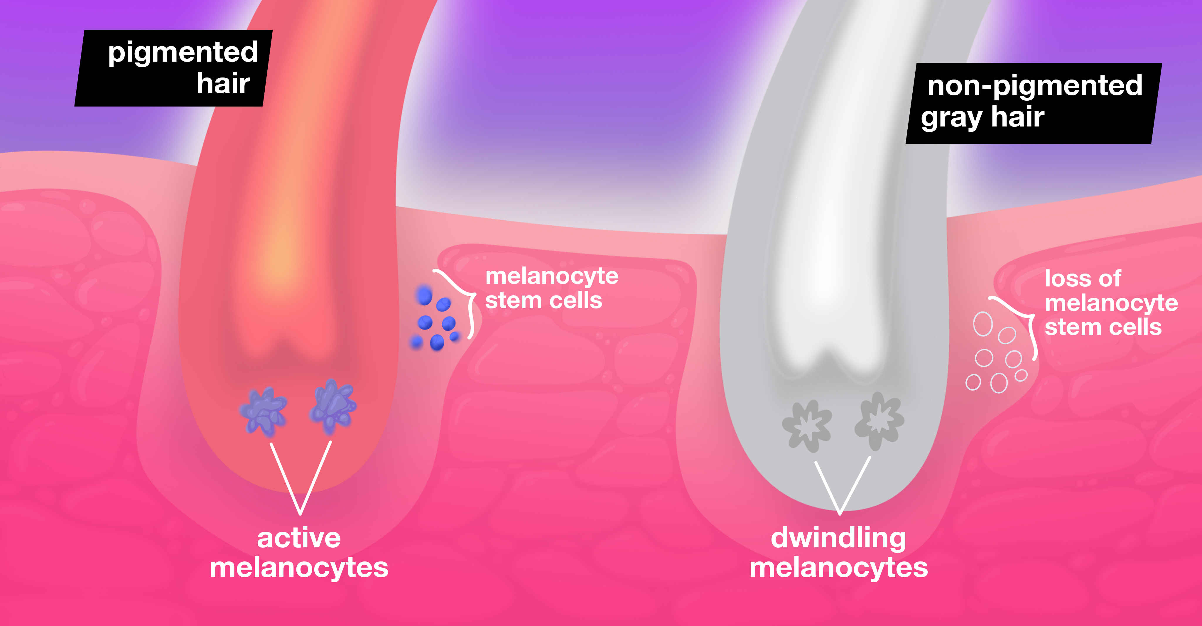 GRAPHIC COMPARING PIGMENTED AND NONPIGMENTED HAIR FOLLICLES