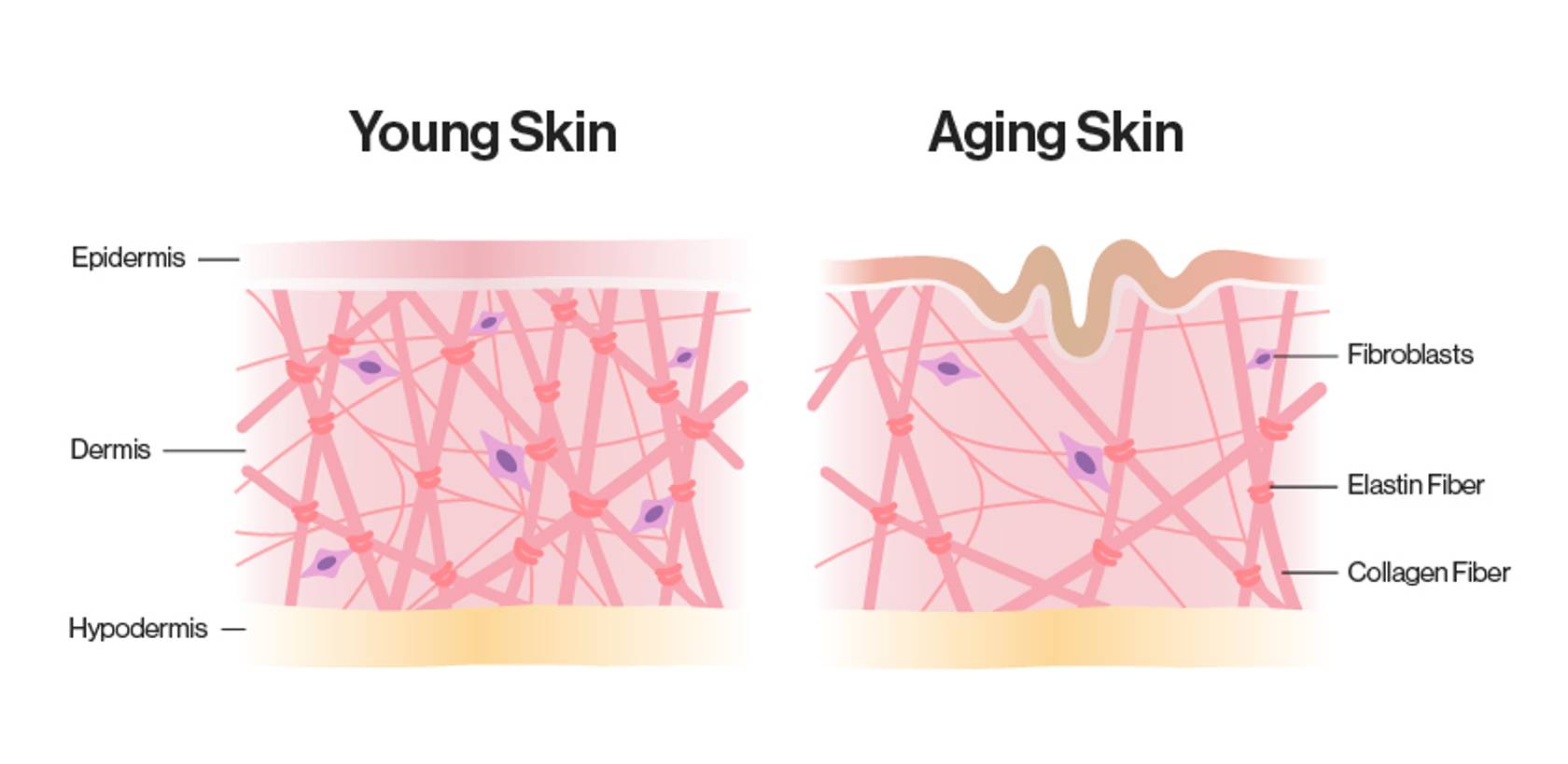 Elastin in young and aging skin