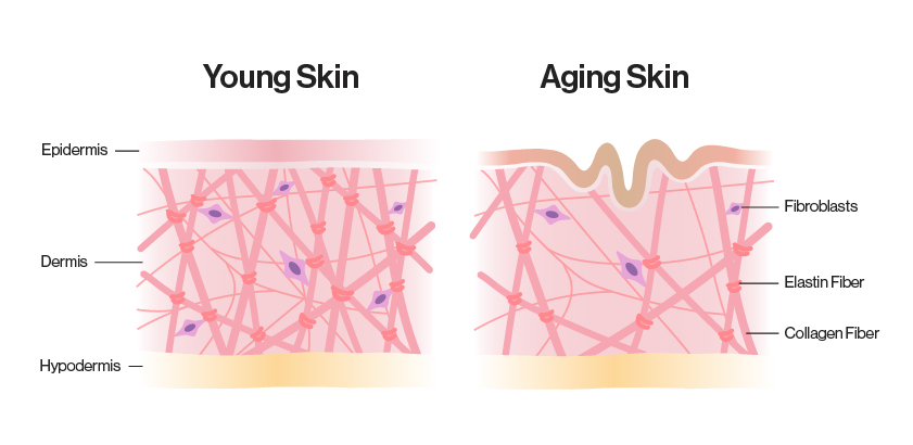 Elastin in young and aging skin
