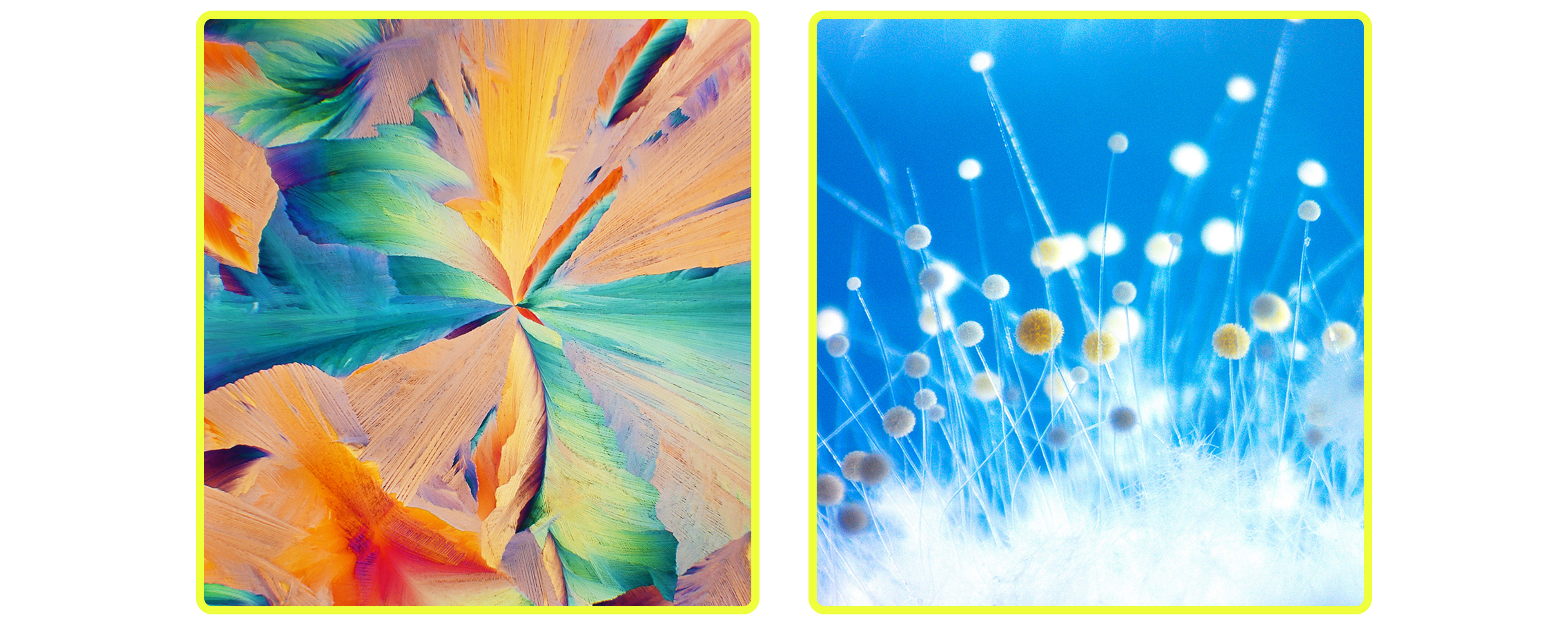 images of mixed amino acid microscopic and Aspergillus flavus fungus microscopic photography by Tracy Debenport