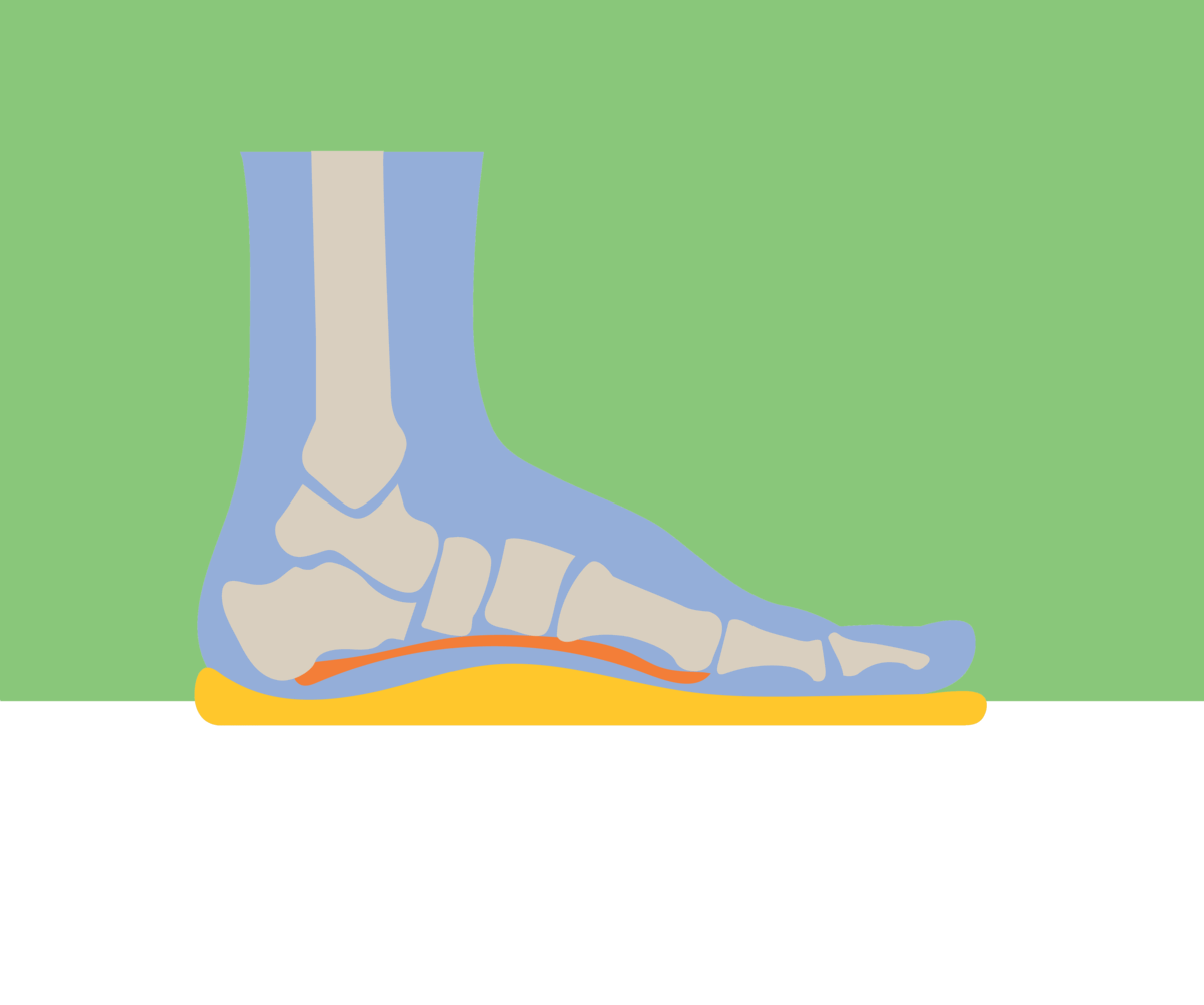 Plantar fasciitis 2025 can be cured