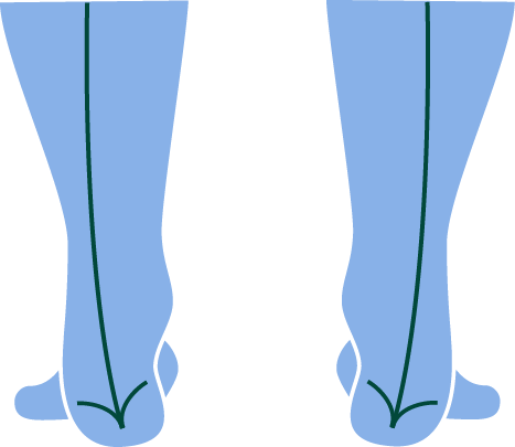 leg pronation