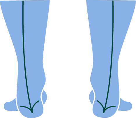 Pronation vs Supination  Learn the Differences and Impacts