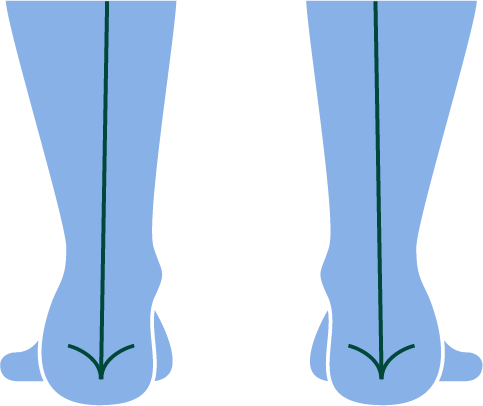 supination of foot