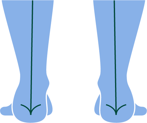 Pronation vs Supination | Learn the Differences and Impacts