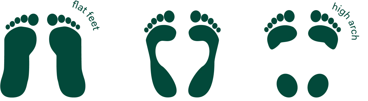 flat feet, high arches, and normal arches