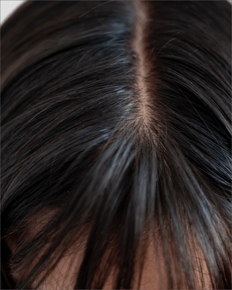 Why is Scalp Health Important?