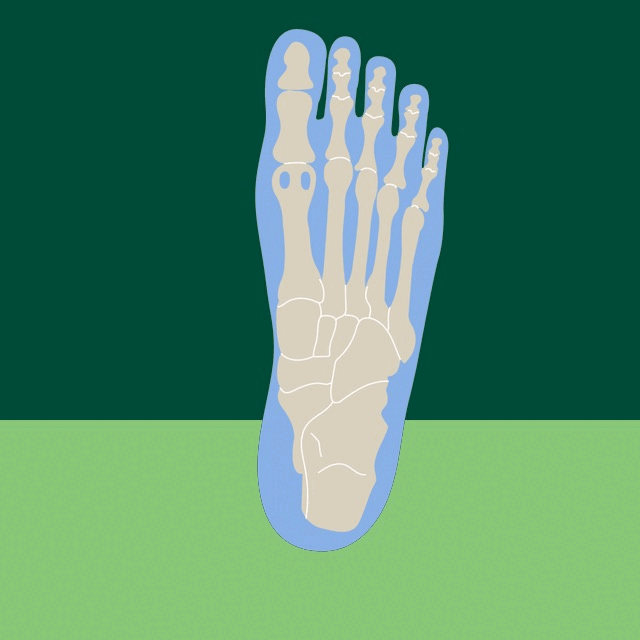 Best athletic shoes for morton's neuroma sales