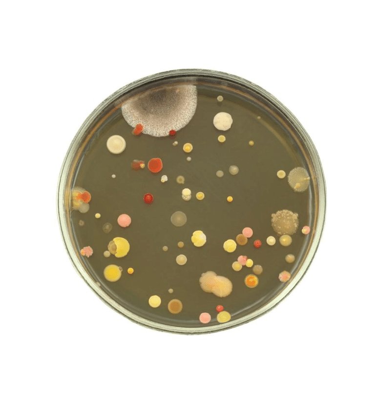 На питательных средах микроорганизмы осуществляют. Чашка Петри с бактериями. Термофильный стрептококк на чашке Петри. Чашка микробиологическая (Петри). Гемолитический стрептококк в чашке Петри.