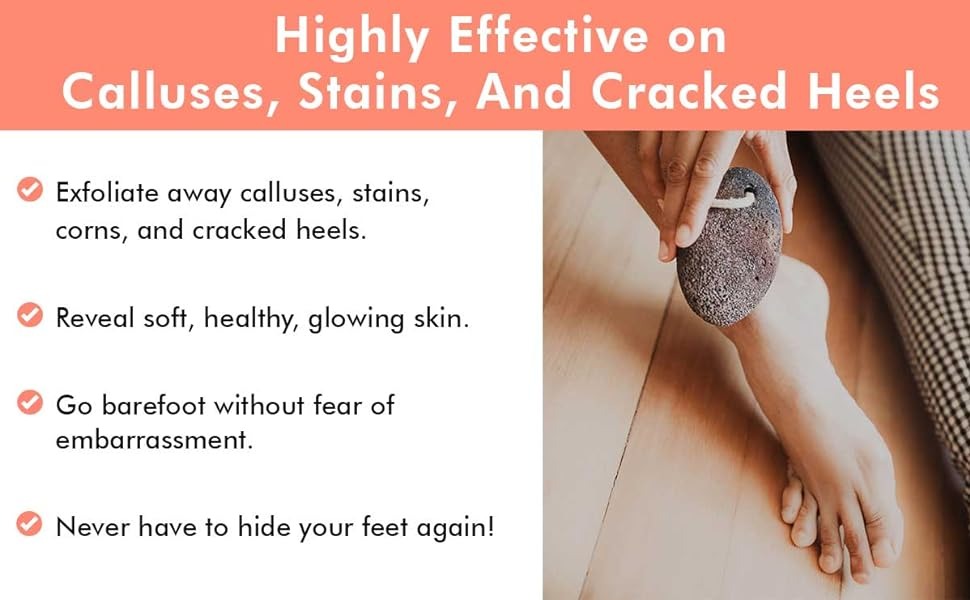 Highly Effective on Calluses, Stains, And Cracked Heels
Exfoliate away calluses, stains, corns, and cracked heels.
Reveal soft, healthy, glowing skin.
Go barefoot without fear of embarrassment.
Never have to hide your feet again!