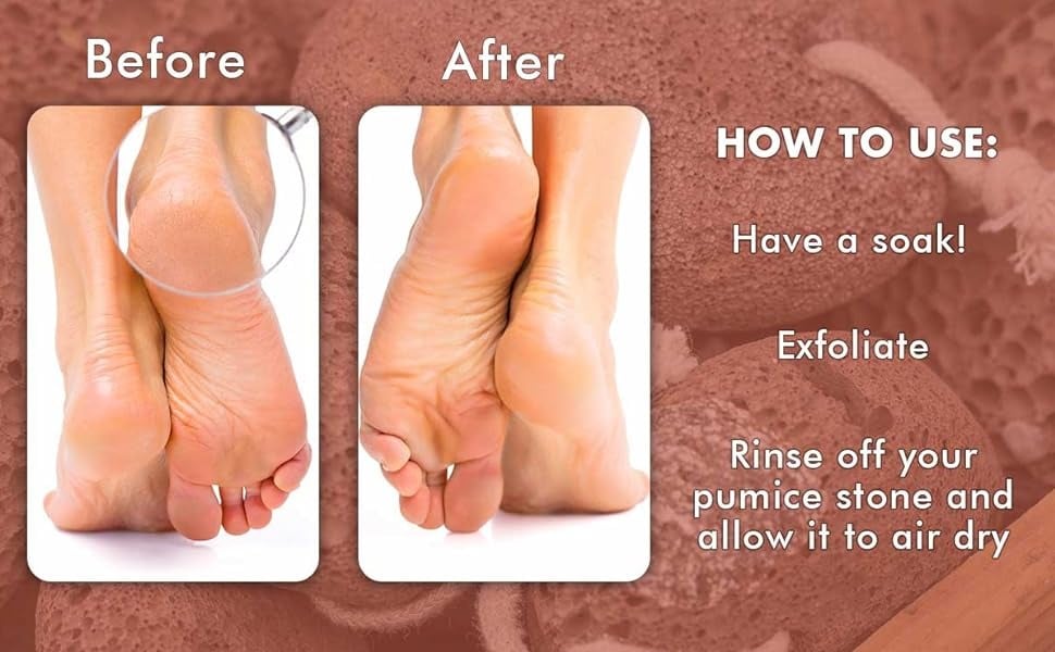 Before and After - 
HOW TO USE:
Have a soak!
Exfoliate
Rinse off your
pumice stone and
allow it to air dry