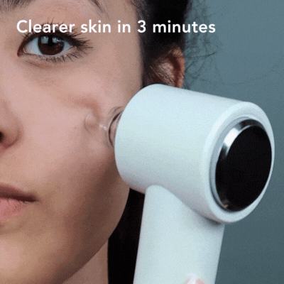 clara microdermabrasion at-home pore vacuum tool_fancii