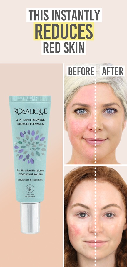 Rosalique Anti Redness 3-in-1 Miracle Formula - Beauty and the Boutique - This instantly reduces red skin