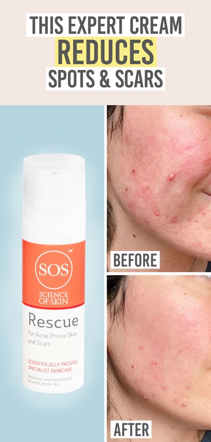 Science of Skincare Rescue - Beauty and the Boutique - This expert cream reduces spots & scars!