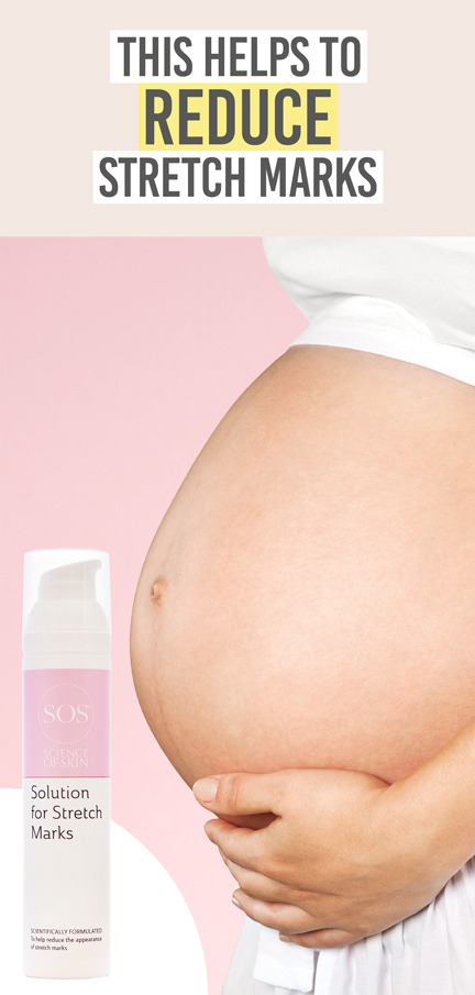 Science of Skincare Solution for Stretch Marks  Beauty and the Boutique - This helps to reduce stretch marks 