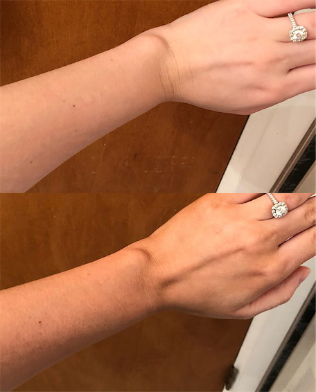 Before and After - Results from Beauty by Earth's Self Tanner Body Lotion
