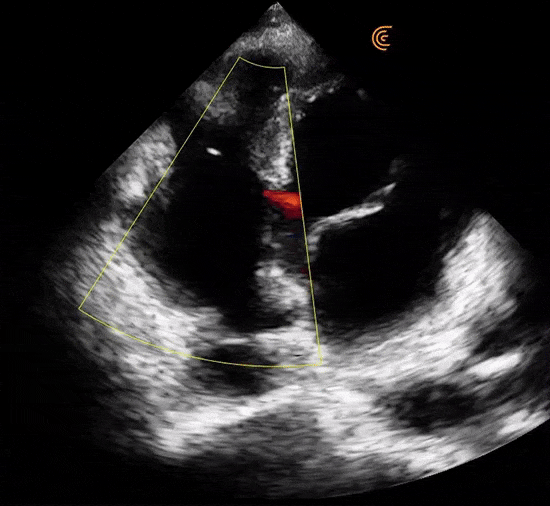 draagbaar echoapparaat, draagbare echografie, prijs draagbaar echoapparaat, draagbare echocardiografie, handheld echocardiografie, draagbaar echoapparaat, prijs echoapparaat, draagbaar echoapparaat voor echocardiografie, prijs draagbaar echoapparaat voor echocardiografie, echoapparaat voor onderzoek aan het bed