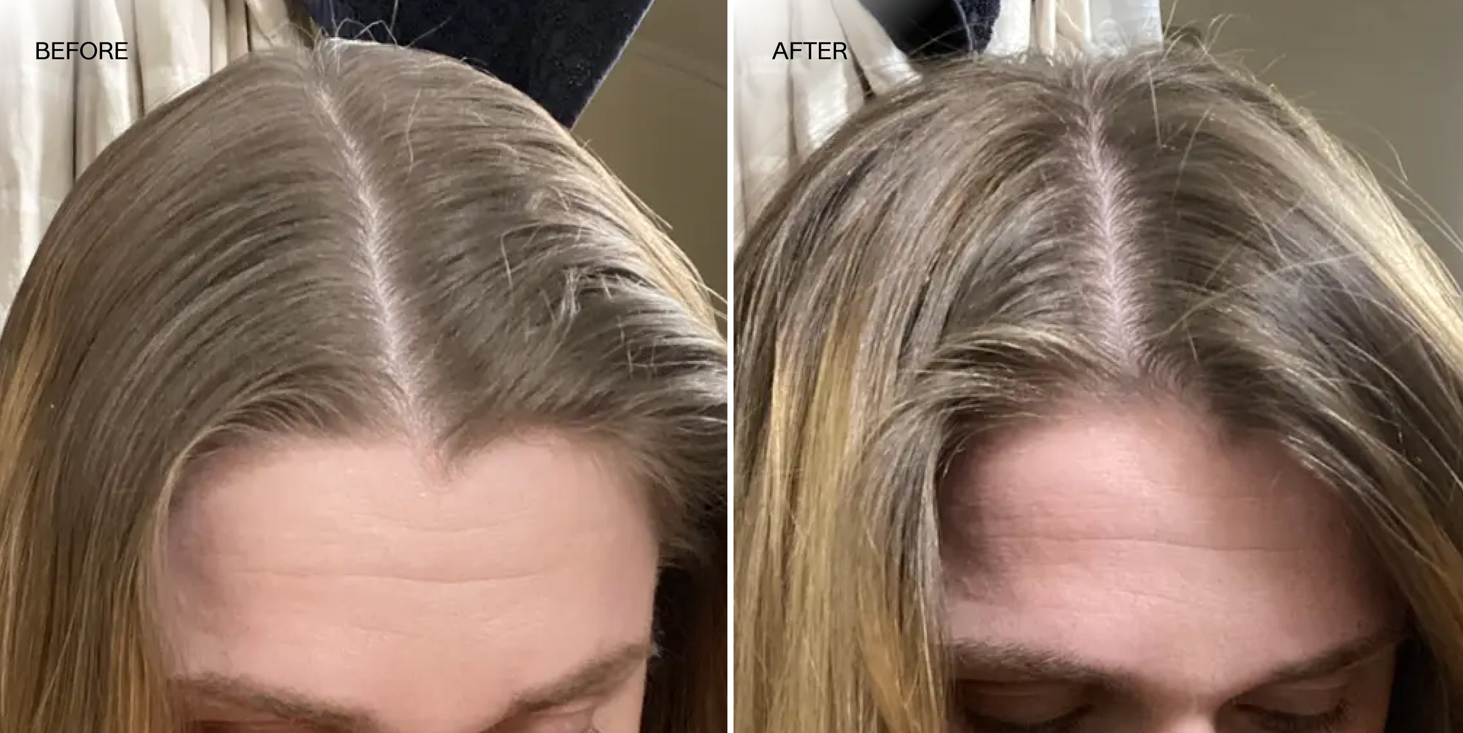 JVN Pre-Wash Scalp Oil | Rosemary-Infused Scalp Treatment – JVN Hair