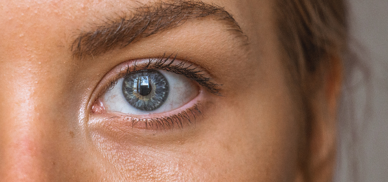 Adult Acne: Why Am I Still Getting Spots?