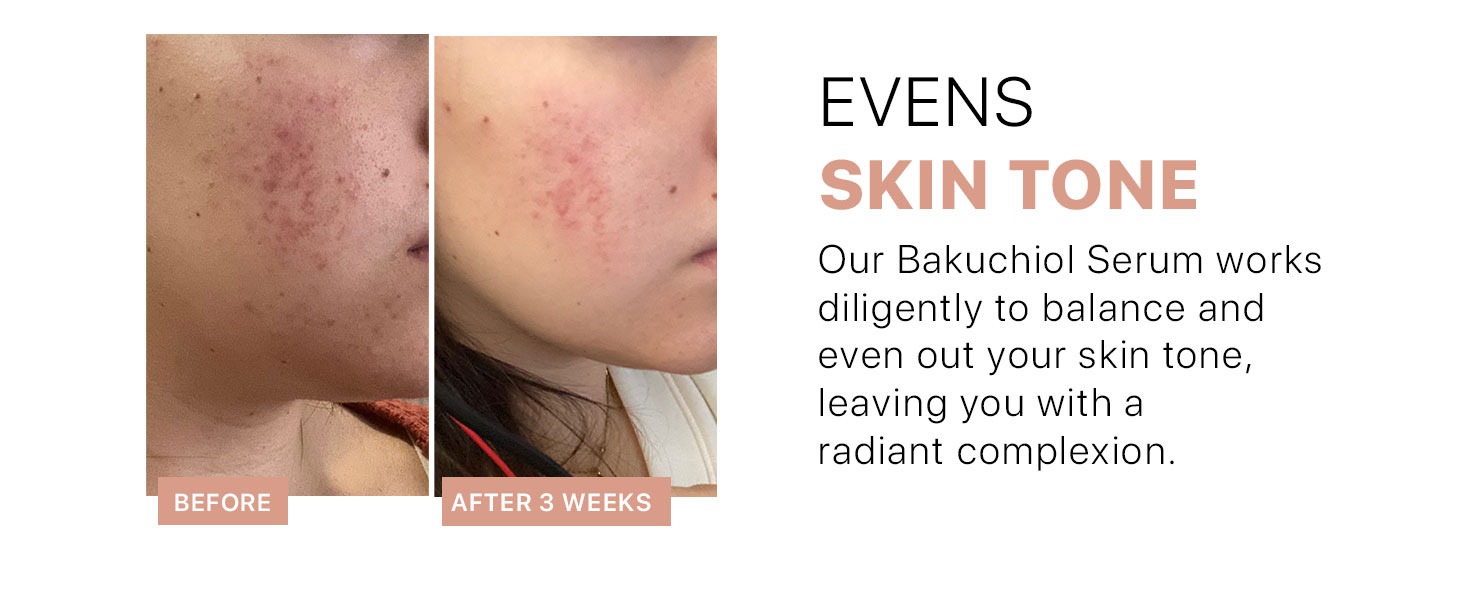 EVENS SKIN TONE
Our Bakuchiol Serum works diligently to balance and even out your skin tone, leaving you with a radiant complexion.