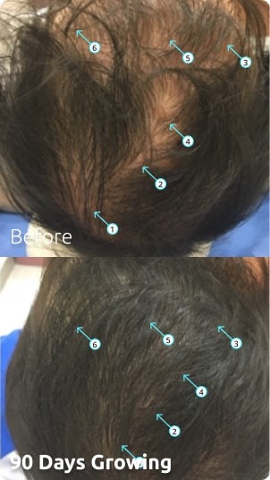 Revita | High-Performance Hair DENSITY Shampoo v2