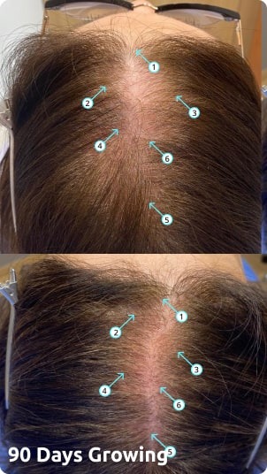 Revita | High-Performance Hair DENSITY Shampoo v2