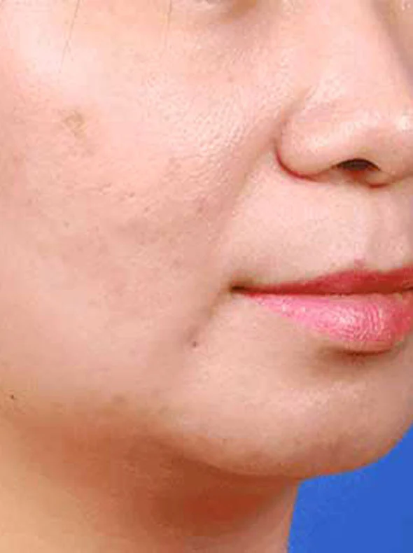 pps-after-1-new.webp?v=1721396499337