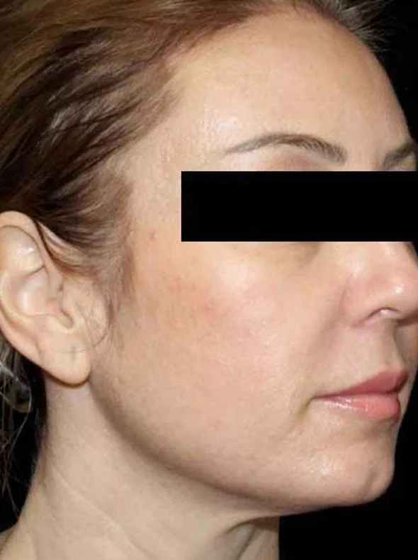 mac-after-5-new.webp?v=1721387423821