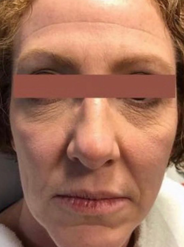 MAC_Pro-Site_PDP_BeforeAfter-03