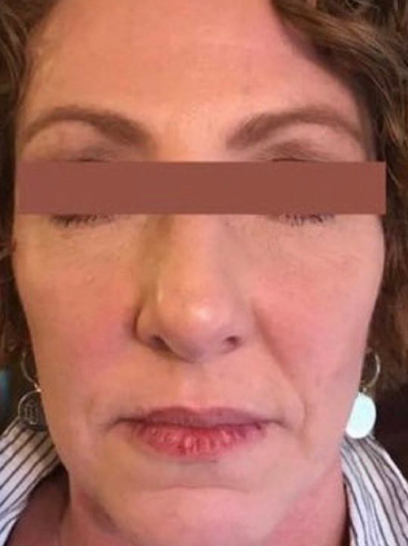 MAC_Pro-Site_PDP_BeforeAfter-04