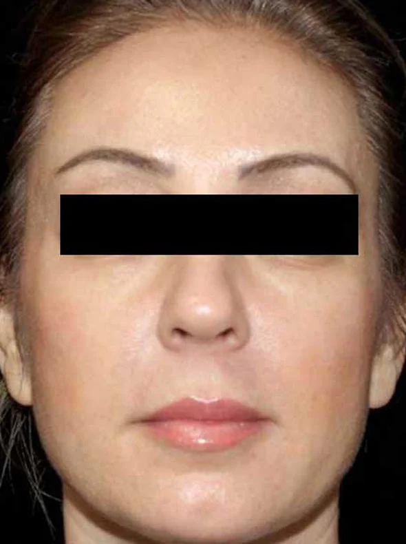 mac-after-1-new.webp?v=1721388849558