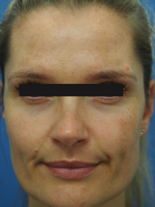 RHC_Pro-Site_BeforeAfter_PDP-01