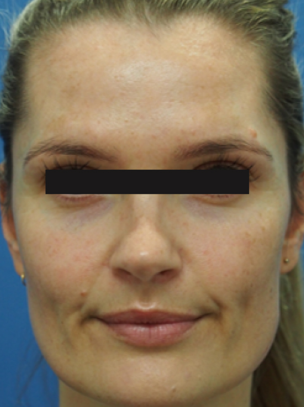 RHC_Pro-Site_BeforeAfter_PDP-03