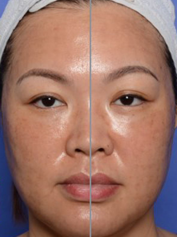 RNC_Pro-Site_Before_PDP-04-(1)